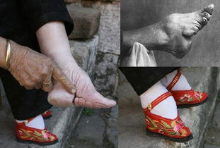 缠足起源于哪个朝代,中国古代妇女缠足始于哪个朝代？